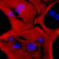 heart muscle cell