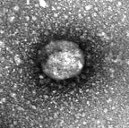 Infectious bronchitis virus