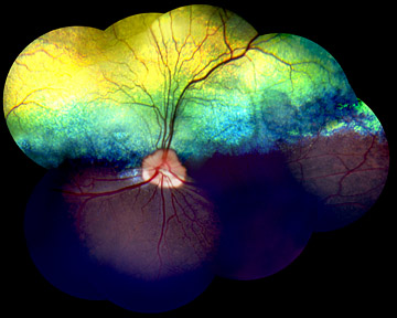 damage to the retina of an English mastiff