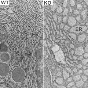 transmission electron microscopic image