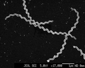 electron micrograph of the pathogen