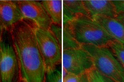 Endothelial cells on biomaterial substrates