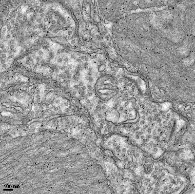 Transmission electron photomicrograph