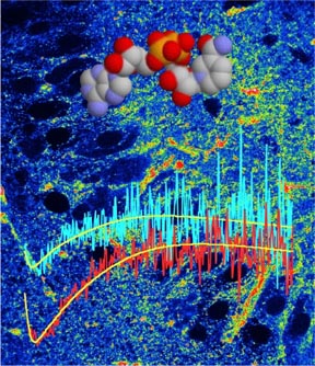 Metabolic dynamics in the brain are imaged