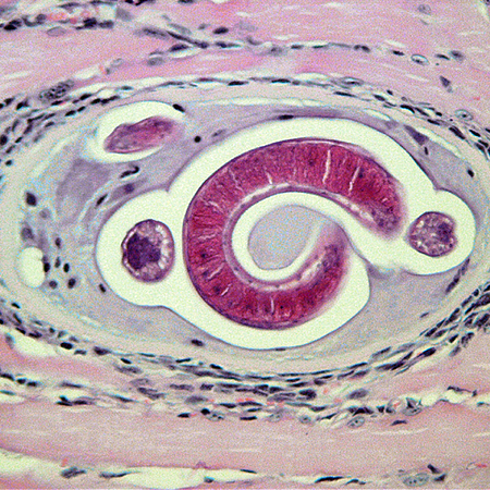 Trichinella spiralis