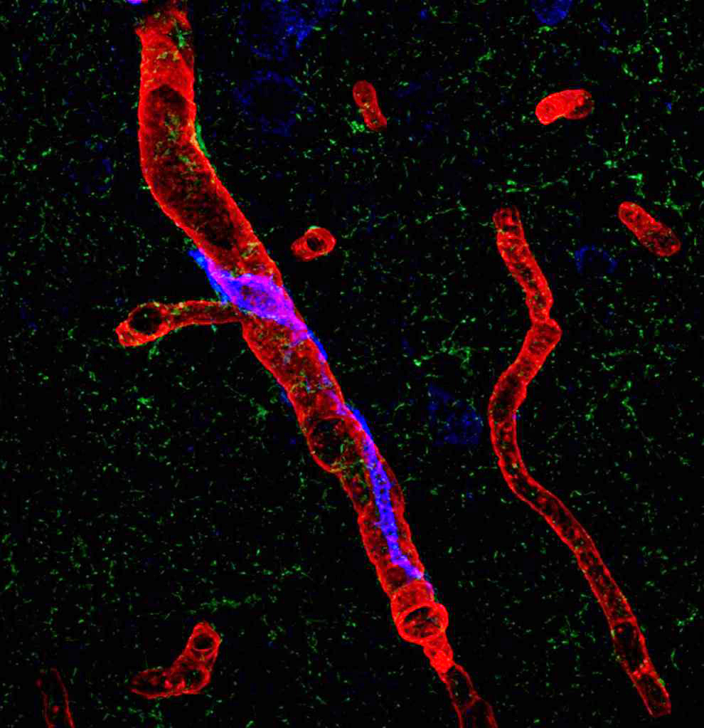 Brain perivascular macrophages