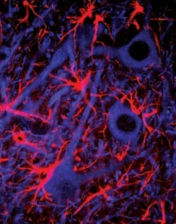 Starburst-shaped astrocytes (red cells) and neurons (blue cells)