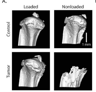 3-D microCT reconstructions