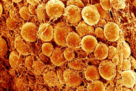 Fat cells