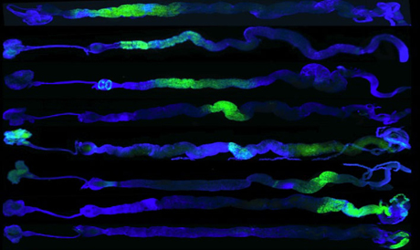 gene patterns in the gut