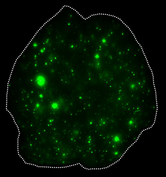 exosomes that have infiltrated the lung