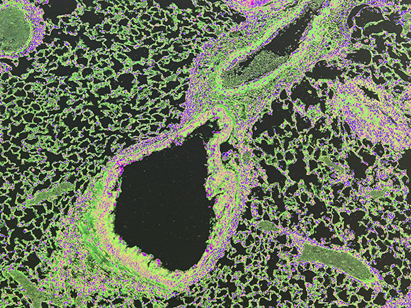 inflammation in mouse lung