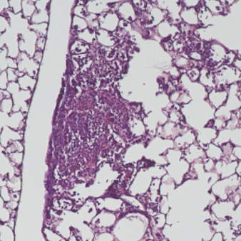 lung tissue